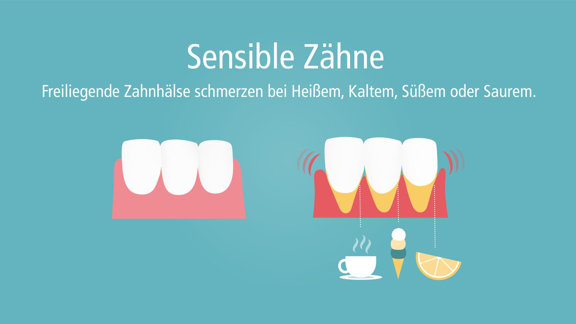 Was macht Zähne weich und angreifbar?